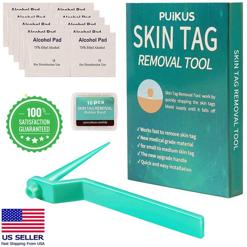 Micro skin tag remover tool - skin,